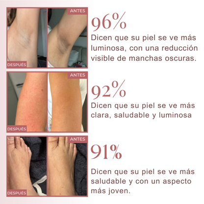 Spray Exfoliante Corporal con Ácido Kójico + Cúrcuma